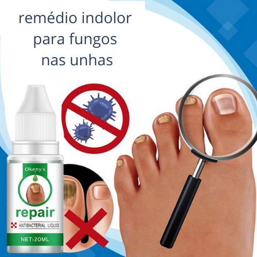 Tratamento para Micose e Fungos Para Unhas