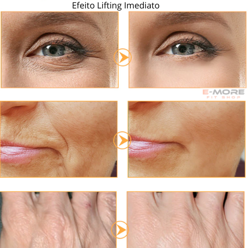 Creme FaceSlift - Remove manchas e imperfeições do Rosto