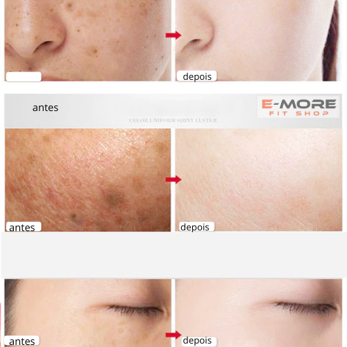 Creme FaceSlift - Remove manchas e imperfeições do Rosto